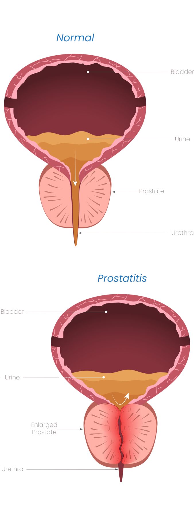 Prostate
