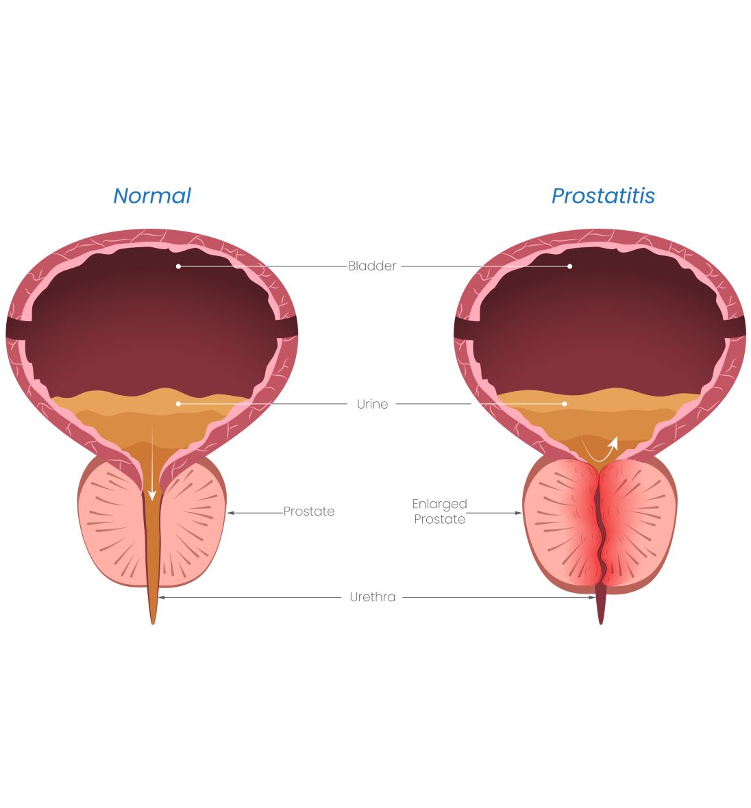 Prostate